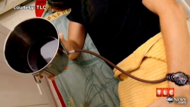 enema9f-3-web.1500x1000